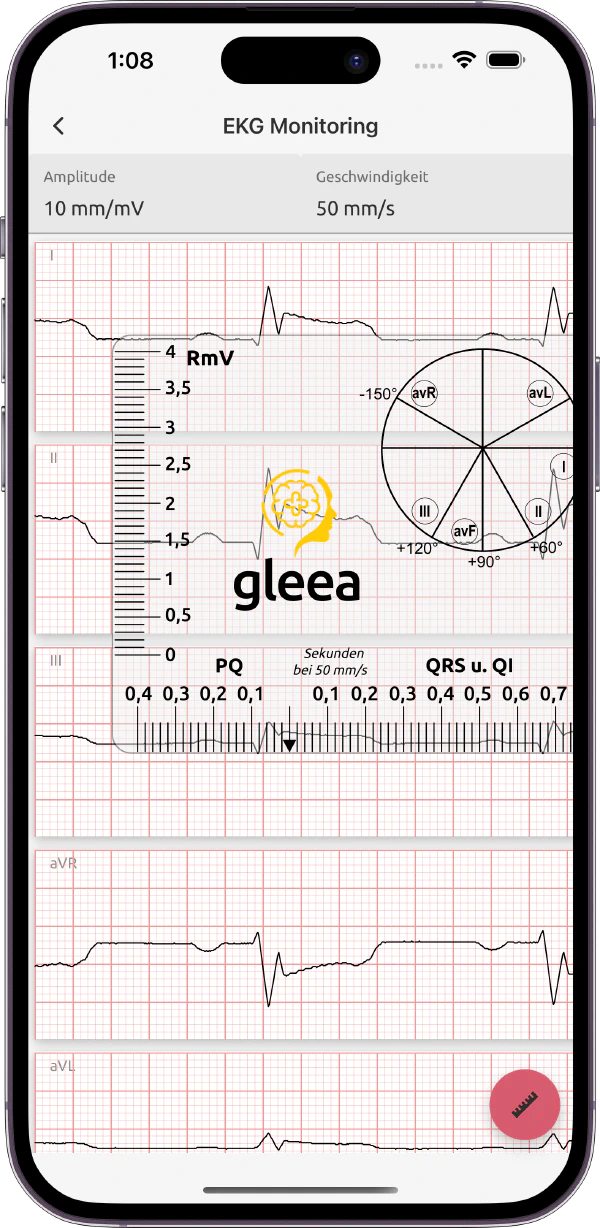 EKG